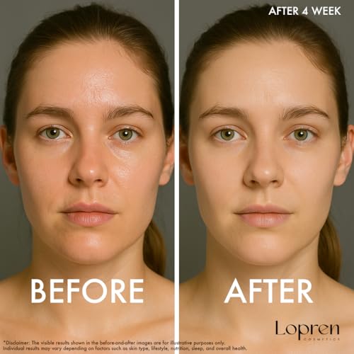Lopren Niacinamide & Hyaluronic Serum – Oil Control, Pore Minimizer, Blemish & Hydrating Face Serum