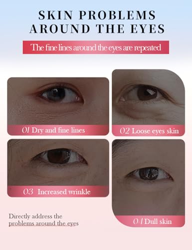 80 PCS Under Eye Patches with Niacinamide & Collagen for Dark Circles & Puffiness