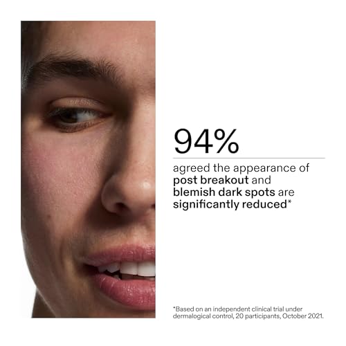 The INKEY List Mandelic Acid Treatment for Hyperpigmentation & Acne Scars