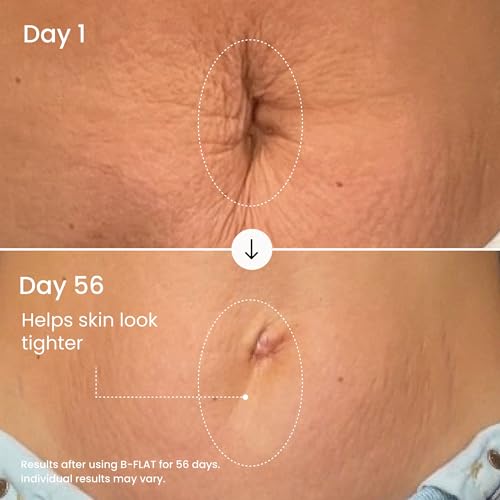 MA?LYS B-FLAT Belly Firming Cream for Women - Skin Tightening & Moisturizing Treatment with Shea Butter & Bentonite Clay - Smooths Look of Stretch Marks - Postpartum Body Care (2 Pack)
