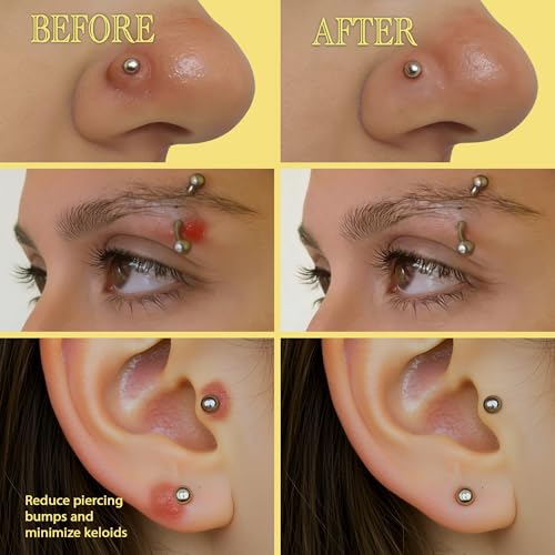 BodyJ4You Keloid Bump Removal Oil - Piercing Aftercare Shrinking Drops - Nose Ear Septum Belly Cartilage Scar Treatment Piercing Bump Solution - Tea Tree Jojoba Essential Oils Keloid Care - 0.33 Fl Oz