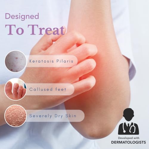 Theraplex FT Exfoliating Emollient Cream for KP 3 Oz with Peppermint - Bumpy Skin Relief
