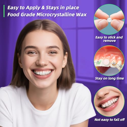 Rizuko Orthodontic Wax for Braces Mint 180 Count - Strong Hold, Long-lasting Relief
