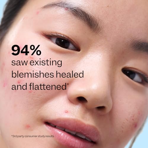 Peach Slices Acne Exfoliating Toner - 2% Salicylic Acid, 4.05 oz