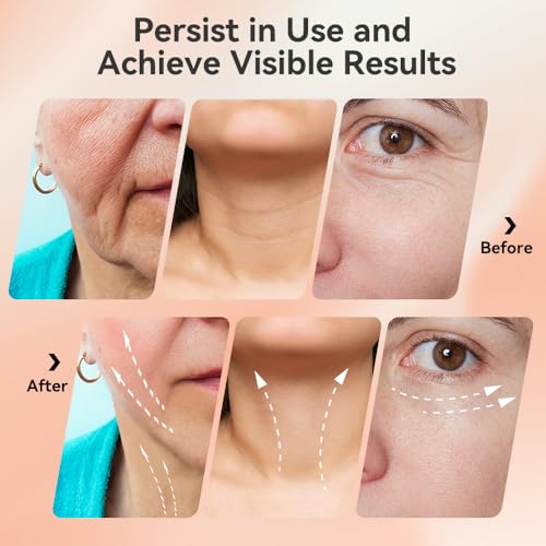 Ihelol 7-Color LED Facial Massager for Face & Neck Sculpting