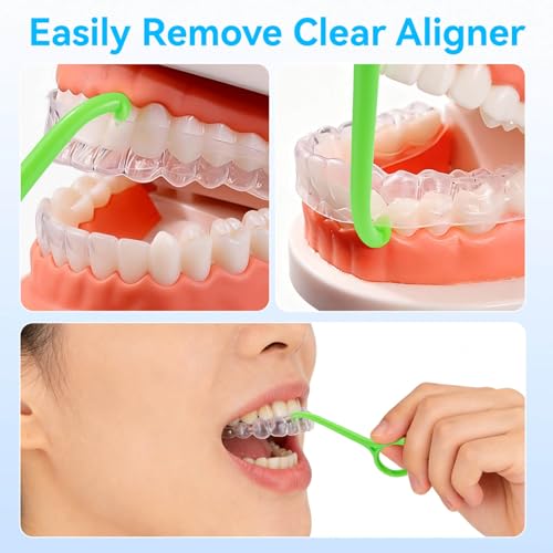 15PCS Clear Aligner Removal Tool for Invisalign - Ergonomic & Gentle