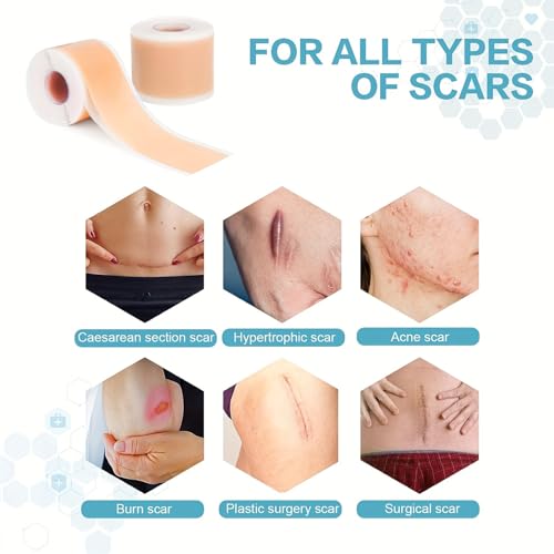 Medical-Grade Silicone Scar Sheets 1.6" x 157" Roll - Keloid, C-Section, Acne Treatment