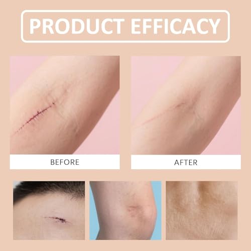 Silicone Scar Stick 2Pcs for Face & Body – Lightweight, Non-Greasy, Twist-Up Roll-On