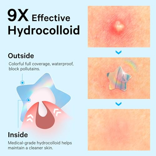Sosky Holographic Pimple Patches - Cute Acne Stickers with Salicylic Acid, 144 Count
