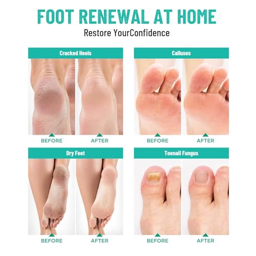 Lavender Foot Soak with Epsom Salt - 12 Pack Pedicure Spa