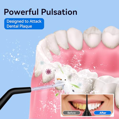 Cordless Water Flosser with 300ML Tank - Rechargeable Oral Irrigator for Travel & Sensitive Gums