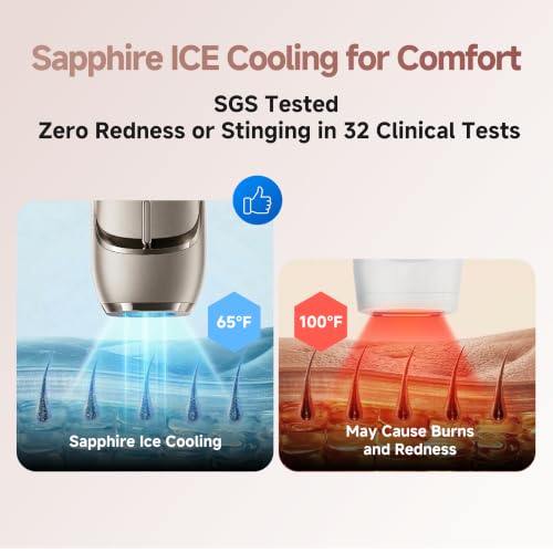 Dreame Nova IPL Hair Removal with Dual-Lamp 27J Output, Sapphire ICE Cooling, 3.9cm©÷ Window, 0.2s Flash, Adaptizone AI Detection, Photon Skincare, Up to 96% Reduction Full-Body for Women and Men