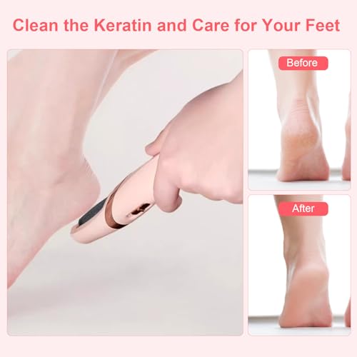 Zerone Replacement Electric Foot File Roller Heads - 10 Pack