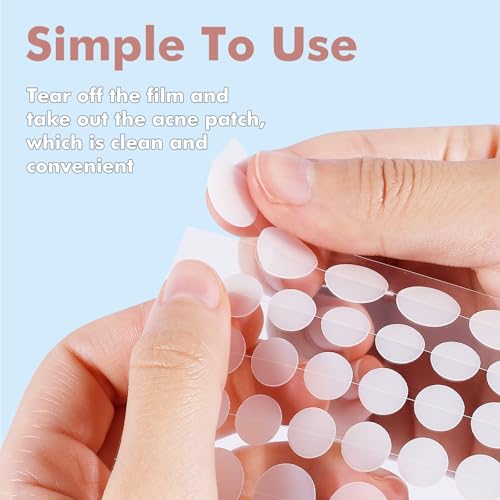 Hydrocolloid Pimple Patches - 304pcs Star-Shaped Acne Treatment
