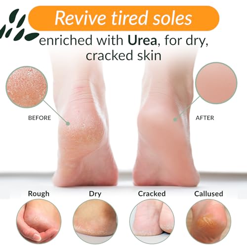 Tree To Tub Urea Foot Cream for Dry Cracked Heels - 3.4 Fl Oz