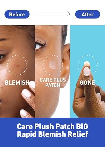 OLIVE YOUNG Hydrocolloid Acne Spot Patch - 102 Count