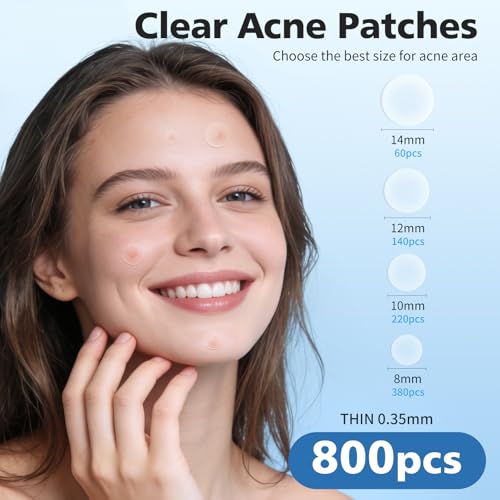 QUSTERE Hydrocolloid Pimple Patches for Face - 800 Count, 4 Sizes