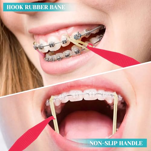 30 Pcs Disposable Rubber Bands Placers for Braces - Multicolored