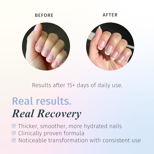 Duri Rejuvacote 1 Original Maximum Strength Nail Growth System Base and Top Coat - Nail Hardener Repair Chipping Strengthen Breaking and Brittle Treatment, by Duri Cosmetics (Pack of 1)