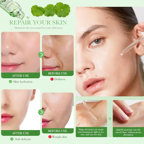 BIOAQUA Centella Asiatica Facial Serum for Oily Skin - 30ml