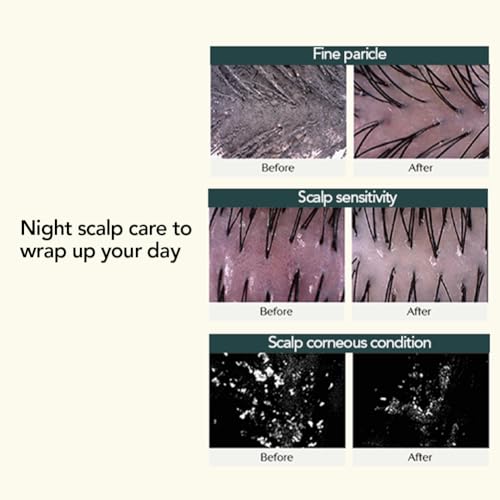 TREECELL Night Collagen Shampoo - 17.58 Fl Oz | Deep Hydration & Cleansing