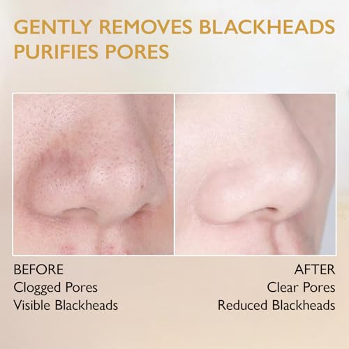 Charcoal Peel-Off Blackhead Remover Mask - 2.1 oz for Nose & T-Zone