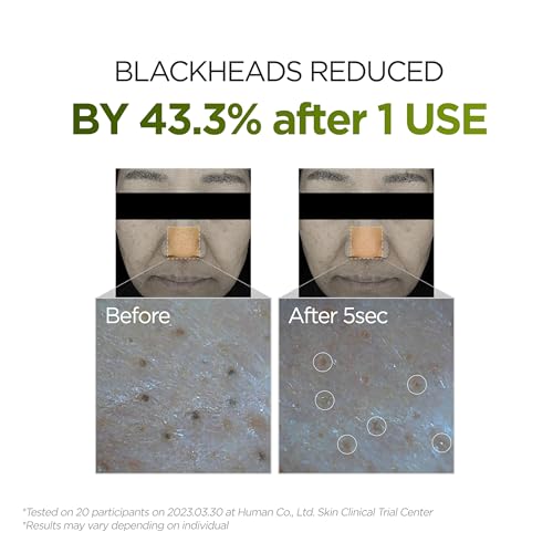 P.CALM Holy Basil Cleansing Oil - 190ml for Blackhead Removal