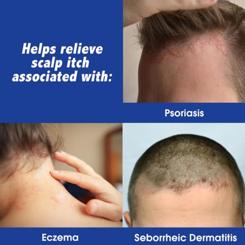 Scalpicin Maximum Strength Scalp Treatment Liquid for Itchy Scalp, Seborrheic Dermatitis & Psoriasis Scalp Treatment, Fragrance-Free, 1.5 fl oz