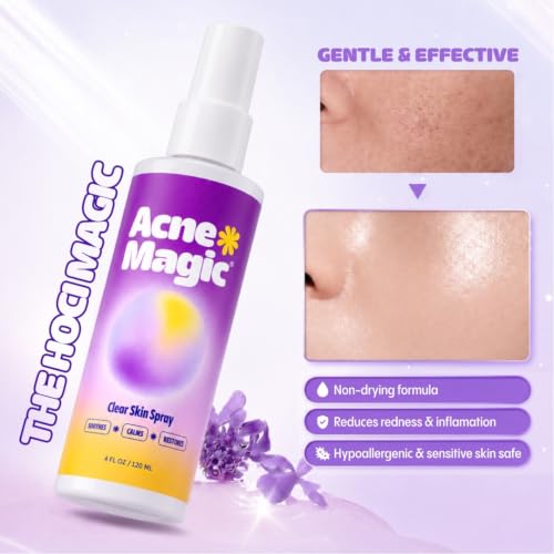 Acne Magic Facial Mist - Daily Skin Refresh Spray for Breakout-Prone Skin
