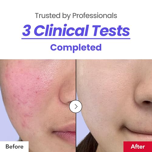 Calming 64% Cream for Sensitive Skin — Redness & Acne Relief, Hydration & Barrier Support (30ml)