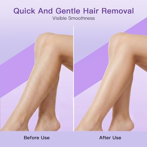 Hair Removal Cream & Spray Kit for Women & Men, Gentle Depilatory Set, Fast-Acting Body Hair Remover for Sensitive Skin, Full Body Use on Legs, Arms, Underarms & Bikini?140ml Spray + 100g Cream