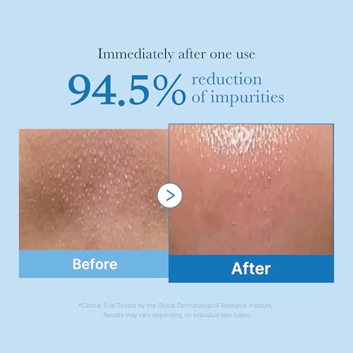 Medicube Zero Pore Cleansing Oil - Blackhead Remover & Makeup Cleanser