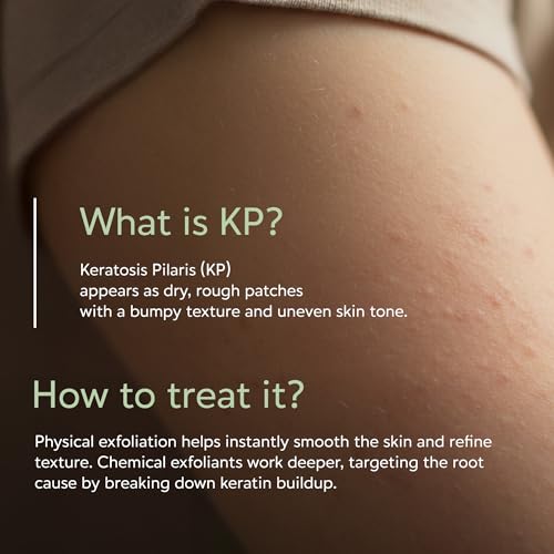 Glycology Glycolic Acid Body Wash for Keratosis Pilaris - 7.5oz