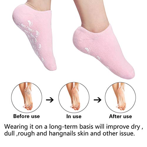 Moisturizing Gel Socks for Foot Care - Blue & Pink, 2 Pairs