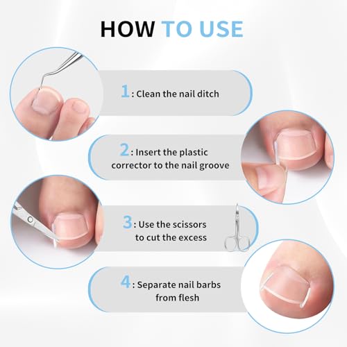 Pain-Free Ingrown Toenail Removal Kit with Straightener Strips - 62 Pcs