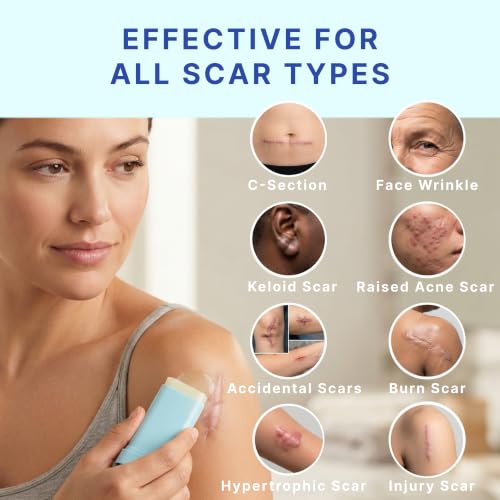 Suquato Silicone Scar Stick – Advanced Scar Treatment for Face & Body