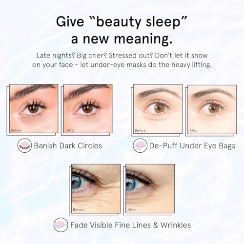 Retinol Under Eye Patches for Puffy Eyes - Purple (24 Pairs)