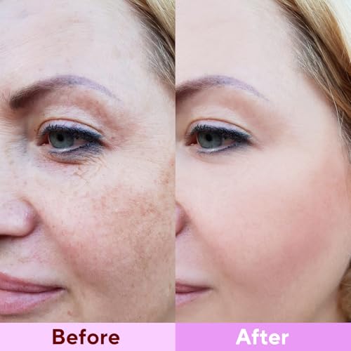 Nityrliv Collagen Face Mask - 4 Pack Deep Hydrating Overnight Mask