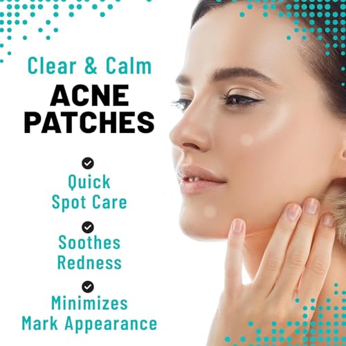 TOLEVITA Microdarts Acne Patches - 18 Count for Blemish Control