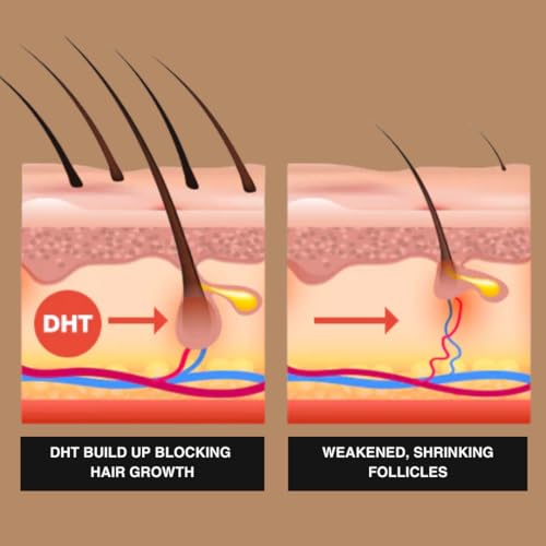 Superior Mane Root Activator Hair Conditioner (250ml) - Thickening Formula for Stronger Follicles & Volume