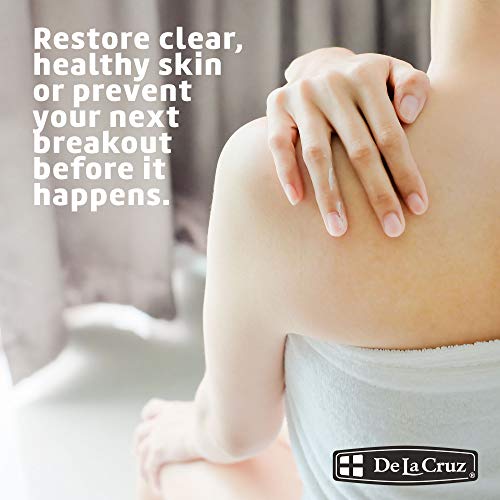 De La Cruz 5% Sulfur Acne Treatment Ointment for Sensitive Skin - 0.42 oz