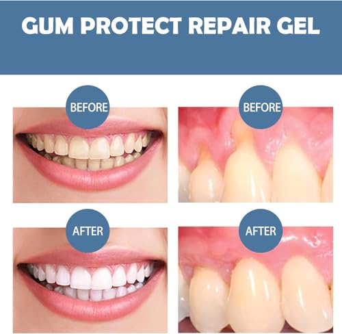 HEDGAUCP Gum Protect Dental Gel, Sulfate-Free Mint Whitening Paste - 3 Pack