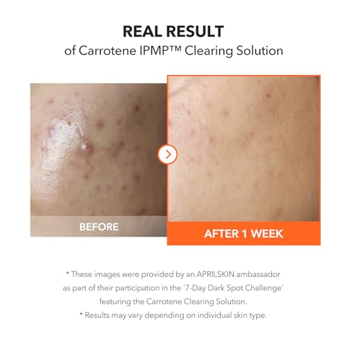 APRILSKIN Carrotene IPMP Clearing Solution (Variation: Carrotene Clearing Solution) - Acne Spot Treatment