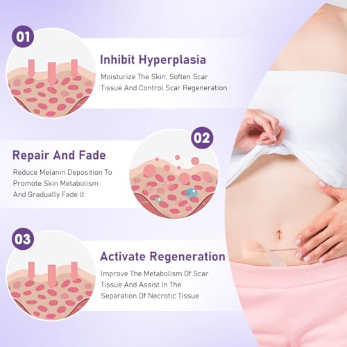 HONGYUNDA 2pcs Silicone Scar Tape for Skin Scar & Wrinkle Reduction