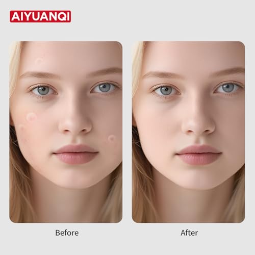 AIYUANQI Large & Small Pimple Patches 180ct with Salicylic Acid & Tea Tree, Hydrocolloid Acne Patches for Spot Concealment