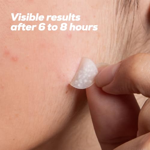 HANHOO Hydrocolloid Blemish Patch - 108 Count Acne Spot Patches