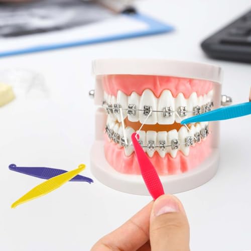 SenseYo 100 Pcs Colorful Dental Elastic Rubber Bands & Placers for Orthodontic Braces