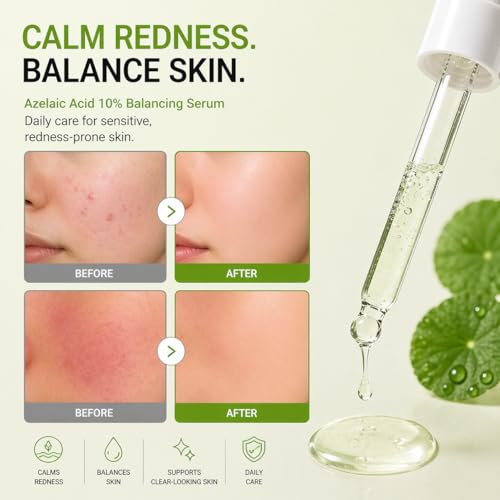 Azelaic Acid 10% Serum for Face Redness & Acne Scar Treatment - Soothing Facial Serum with Niacinamide & Hyaluronan