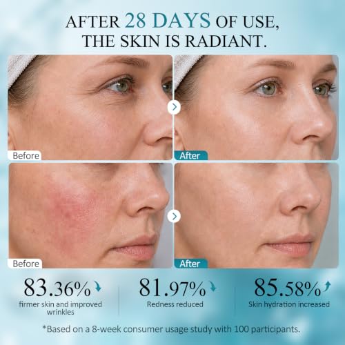 SHVYOG PDRN Hyaluronic Face Moisturizer, Anti-Aging Collagen Cream 1.76 oz