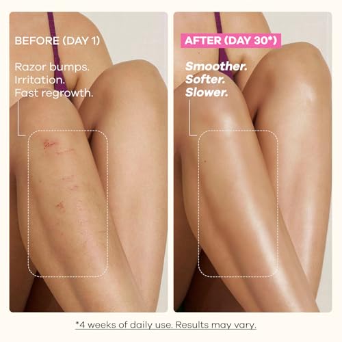 VG VOGCREST Cyperus Rotundus Oil: After Shave Oil for Face & Body - Natural Hair Growth Inhibitor Helps Slow Regrowth - Safe for Sensitive Skin & PCOS (Green, 2 FL OZ)